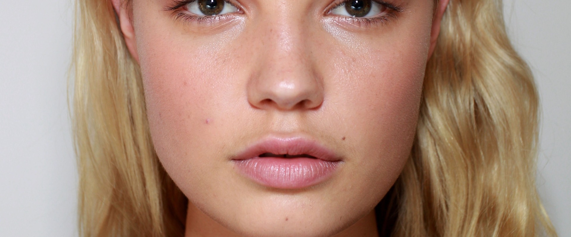 Does Lip Filler Change Your Lips Permanently?