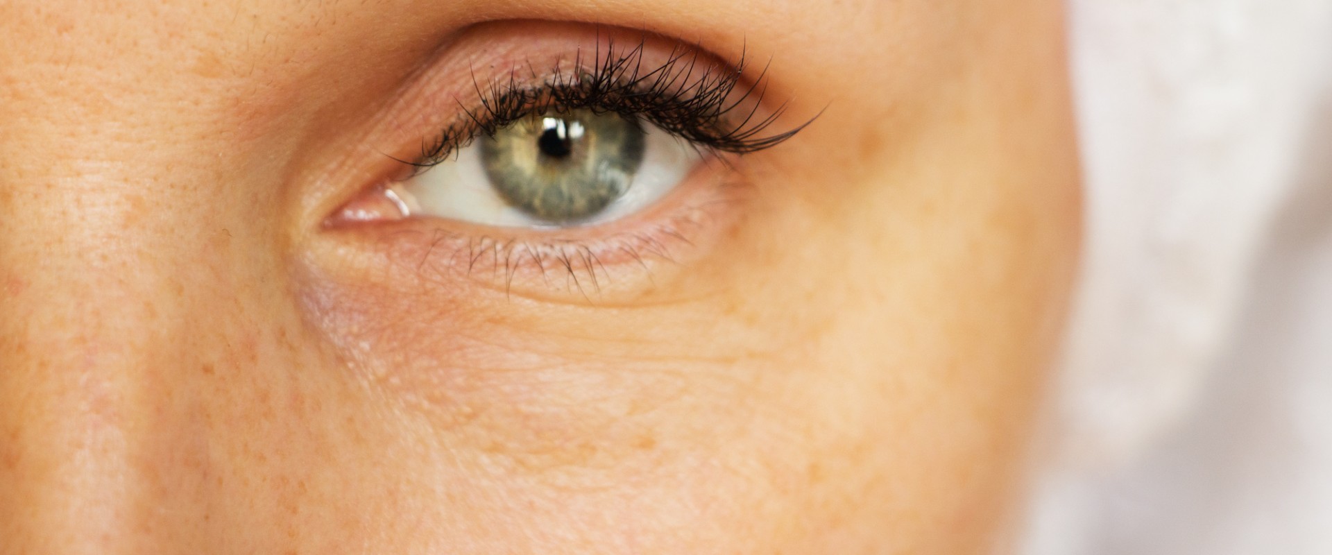 Can Under Eye Fillers Reverse the Signs of Aging?