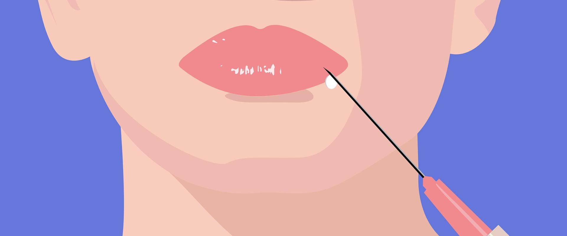 The 5 Most Dangerous Injection Zones for Dermal Fillers