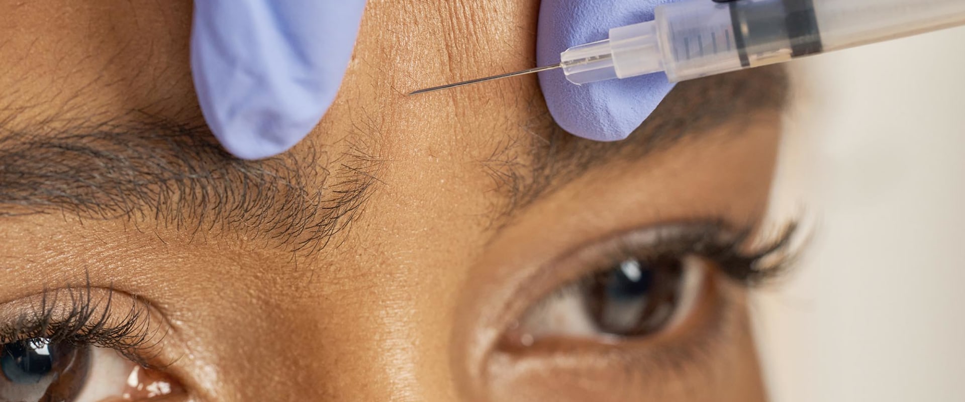 Are Fillers Injected Into the Muscle? An Expert's Perspective