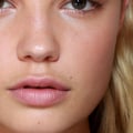 Does Lip Filler Change Your Lips Permanently?