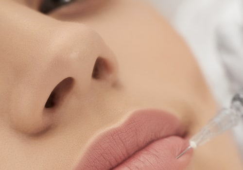 Which Facial Filler Lasts the Longest?